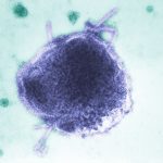 Alberta surpasses 700 confirmed measles cases