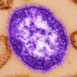 As summer travel gets underway, Alberta has highest measles cases per capita in North America